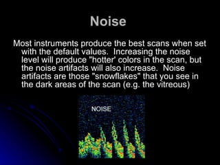 Noise   Most instruments produce the best scans when set with the default values.  Increasing the noise level will produce "hotter' colors in the scan, but the noise artifacts will also increase.  Noise artifacts are those "snowflakes" that you see in the dark areas of the scan (e.g. the vitreous)  