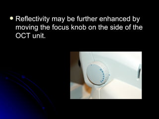 <ul><li>Reflectivity may be further enhanced by moving the focus knob on the side of the OCT unit.   </li></ul>