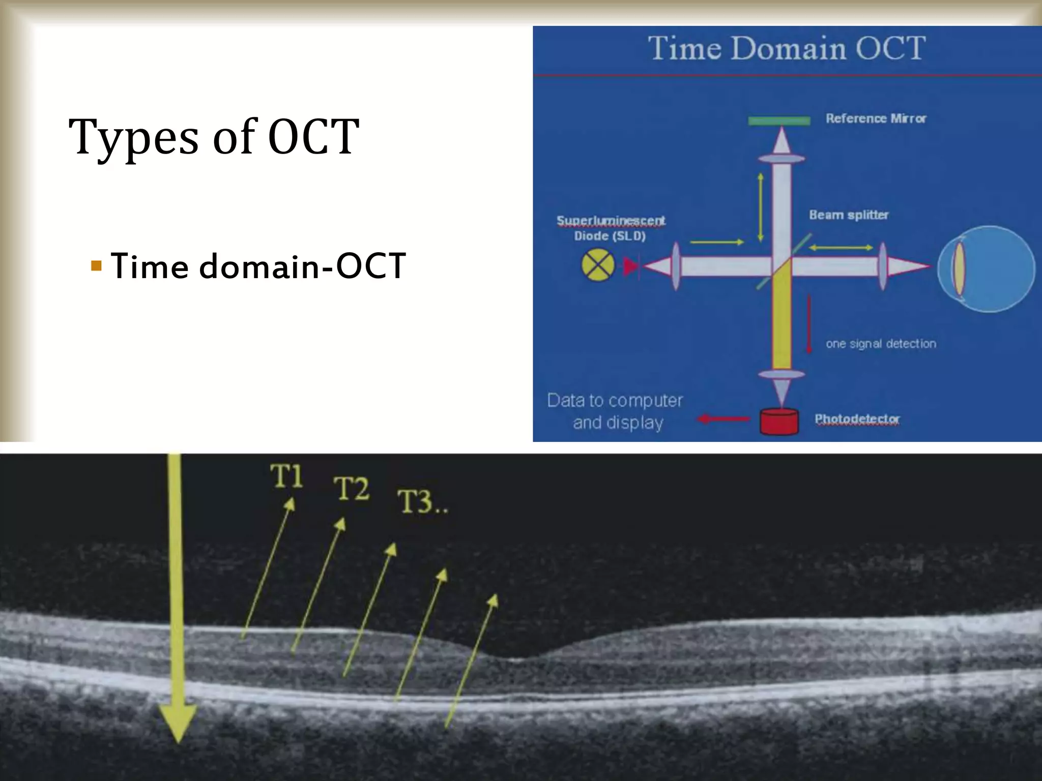 Optical Coherence Tomography | PPTX