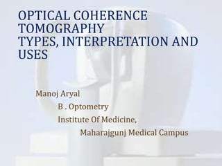 OPTICAL COHERENCE
TOMOGRAPHY
TYPES, INTERPRETATION AND
USES
Manoj Aryal
B . Optometry
Institute Of Medicine,
Maharajgunj Medical Campus
 