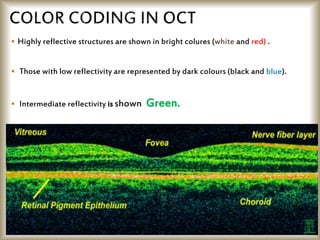  Highly reflective structures are shown in bright colures (white and red) .
 Those with low reflectivity are represented by dark colours (black and blue).
 Intermediate reflectivity is shown Green.
 