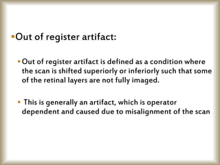 Out of register artifact:
Out of register artifact is defined as a condition where
the scan is shifted superiorly or inferiorly such that some
of the retinal layers are not fully imaged.
 This is generally an artifact, which is operator
dependent and caused due to misalignment of the scan
 