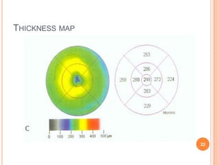 THICKNESS MAP
22
 