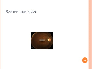 RASTER LINE SCAN
24
 