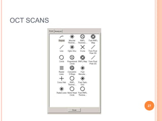OCT SCANS
27
 