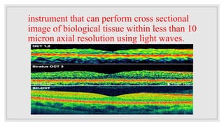 OPTICAL COHERENCE TOMOGRAPHY.pptx