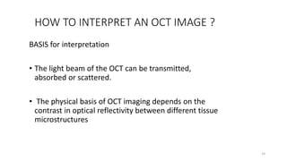 HOW TO INTERPRET AN OCT IMAGE ?
BASIS for interpretation
• The light beam of the OCT can be transmitted,
absorbed or scattered.
• The physical basis of OCT imaging depends on the
contrast in optical reflectivity between different tissue
microstructures
14
 