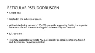 RETICULAR PSEUDODRUSCEN
• Arnold et al
• located in the subretinal space.
• yellow interlacing network 125–250 μm wide appearing first in the superior
outer macula and then extending circumferentially and beyond
• B/L -50-84 %
• strongly associated with late AMD, especially geographic atrophy, type 2
and 3 choroidal neovascularization
 