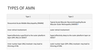 TYPES OF AMN
Type 1 Type 2
Paracentral Acute Middle Maculopathy (PAMM)
Typical Acute Macular Neuroretinopathy/Acute
Macular Outer Retinopathy (AMOR)[4]
inner retinal involvement outer retinal involvement
hyperreflectivity superficial to the outer plexiform
layer (OPL-INL) on SDOCT
hyperreflectivity deep to the outer plexiform layer on
SDOCT
inner nuclear layer (INL) involved- may lead to
thinning of INL
outer nuclear layer (OPL-ONL) involved- may lead to
thinning of ONL
 