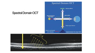 SpectralDomainOCT
 