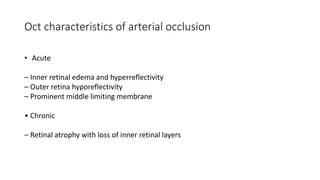 Oct characteristics of arterial occlusion
• Acute
– Inner retinal edema and hyperreflectivity
– Outer retina hyporeflectivity
– Prominent middle limiting membrane
• Chronic
– Retinal atrophy with loss of inner retinal layers
 