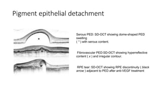 Optical coherence tomography)(OCT) | PPTX
