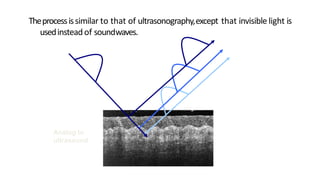Theprocessissimilar to that of ultrasonography,except that invisible light is
usedinstead of soundwaves.
Analog to
ultrasound
 