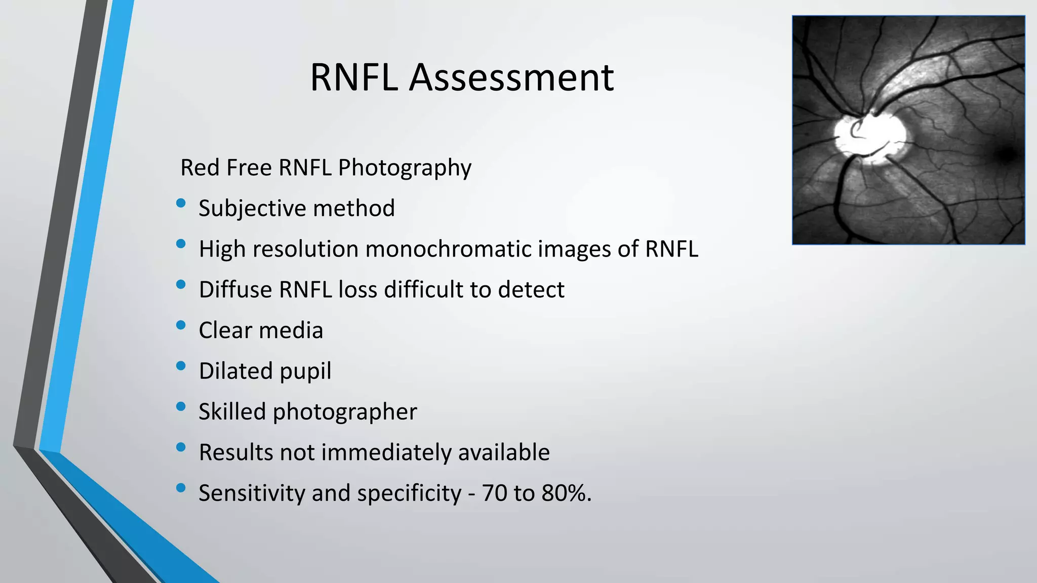 Optical coherence tomography in glaucoma - Dr Shylesh Dabke | PPTX
