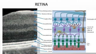 RETINA
 
