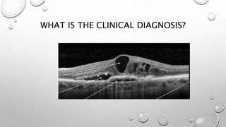 WHAT IS THE CLINICAL DIAGNOSIS?
 
