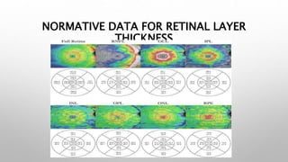 NORMATIVE DATA FOR RETINAL LAYER
THICKNESS
 