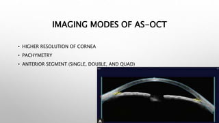 IMAGING MODES OF AS-OCT
• HIGHER RESOLUTION OF CORNEA
• PACHYMETRY
• ANTERIOR SEGMENT (SINGLE, DOUBLE, AND QUAD)
 