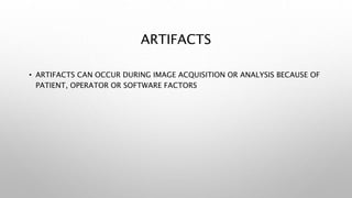 ARTIFACTS
• ARTIFACTS CAN OCCUR DURING IMAGE ACQUISITION OR ANALYSIS BECAUSE OF
PATIENT, OPERATOR OR SOFTWARE FACTORS
 