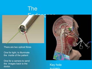 The
Endoscope
There are two optical fibres
One for light, to illuminate
the inside of the patient
One for a camera to send
the images back to the
doctor.
Key hole
 