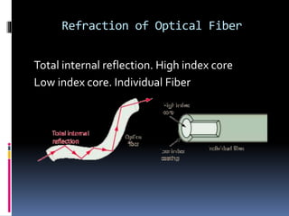 Refraction of Optical Fiber
Total internal reflection. High index core
Low index core. Individual Fiber
 
