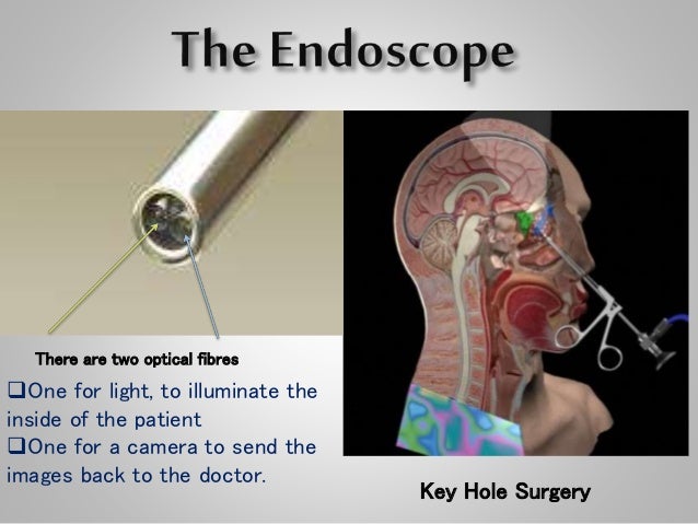 Optical fiber communiction