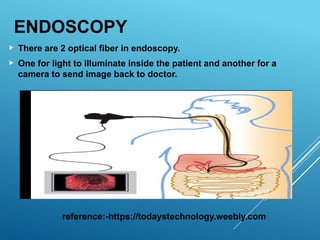 ENDOSCOPY
 There are 2 optical fiber in endoscopy.
 One for light to illuminate inside the patient and another for a
camera to send image back to doctor.
reference:-https://todaystechnology.weebly.com
 