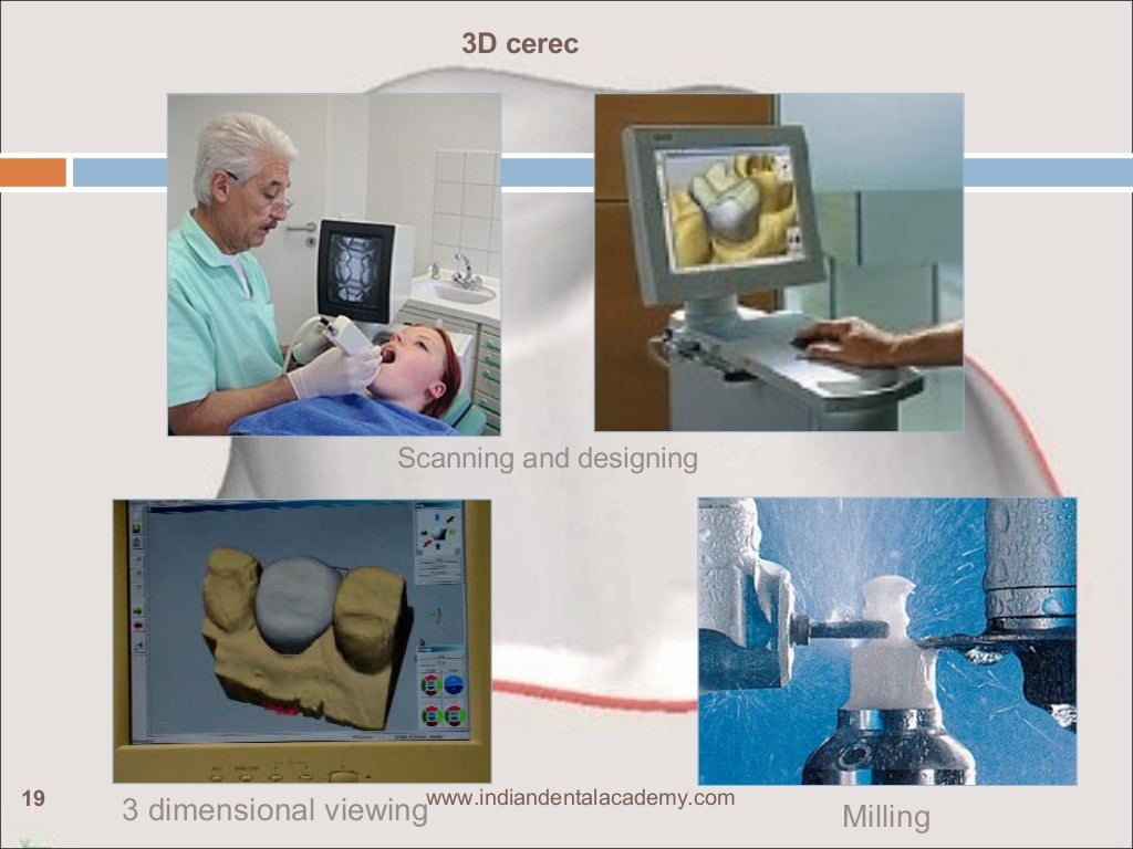 Optical impressions/ dentistry jobs