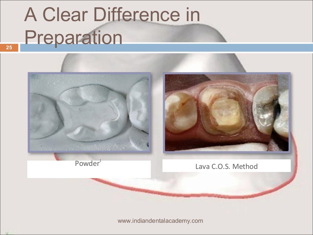 Optical impressions/ dentistry jobs