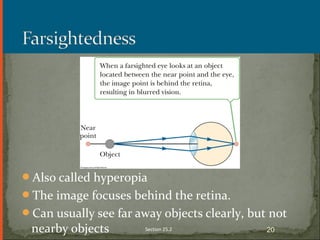 Also called hyperopia
The image focuses behind the retina.
Can usually see far away objects clearly, but not
nearby objects Section 25.2 20
 