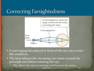 A converging lens placed in front of the eye can correct
the condition.
The lens refracts the incoming rays more toward the
principle axis before entering the eye.
 This allows the rays to converge and focus on the retina.
Section 25.2 21
 