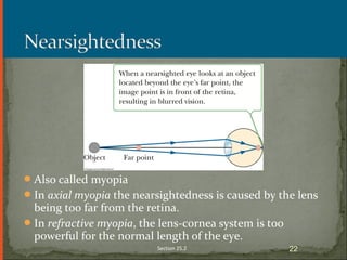 Also called myopia
In axial myopia the nearsightedness is caused by the lens
being too far from the retina.
In refractive myopia, the lens-cornea system is too
powerful for the normal length of the eye.
Section 25.2 22
 