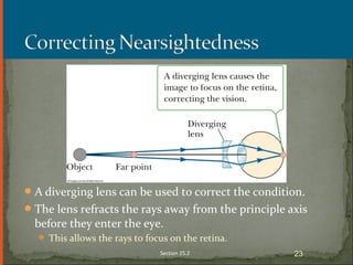 A diverging lens can be used to correct the condition.
The lens refracts the rays away from the principle axis
before they enter the eye.
 This allows the rays to focus on the retina.
Section 25.2 23
 