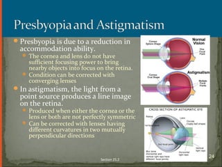 Presbyopia is due to a reduction in
accommodation ability.
 The cornea and lens do not have
sufficient focusing power to bring
nearby objects into focus on the retina.
 Condition can be corrected with
converging lenses
In astigmatism, the light from a
point source produces a line image
on the retina.
 Produced when either the cornea or the
lens or both are not perfectly symmetric
 Can be corrected with lenses having
different curvatures in two mutually
perpendicular directions
Section 25.2
24
 