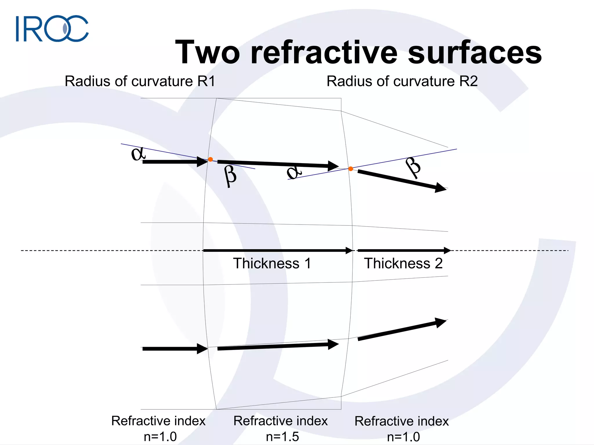 Two refractive surfaces     Thickness 1 Thickness 2 Refractive index  n=1.5 Refractive index  n=1.0 Refractive index  n=1.0 Radius of curvature R1 Radius of curvature R2 