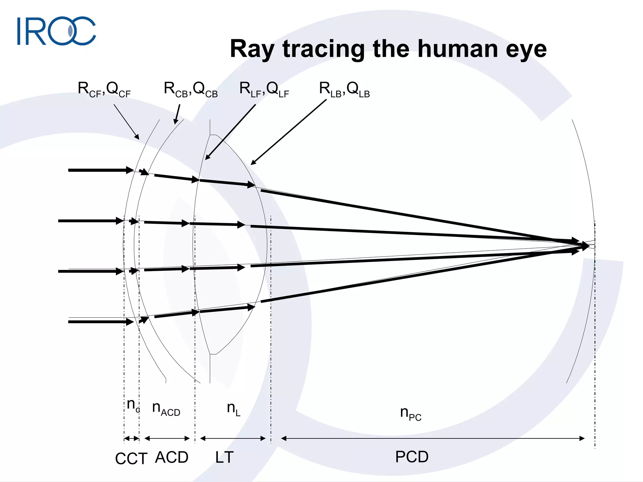 Ray tracing the human eye CCT ACD LT PCD n c n ACD n L n PC R CF ,Q CF R CB ,Q CB R LF ,Q LF R LB ,Q LB 