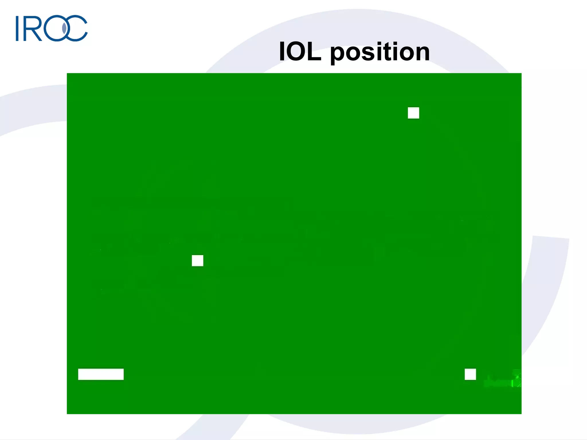 IOL position 