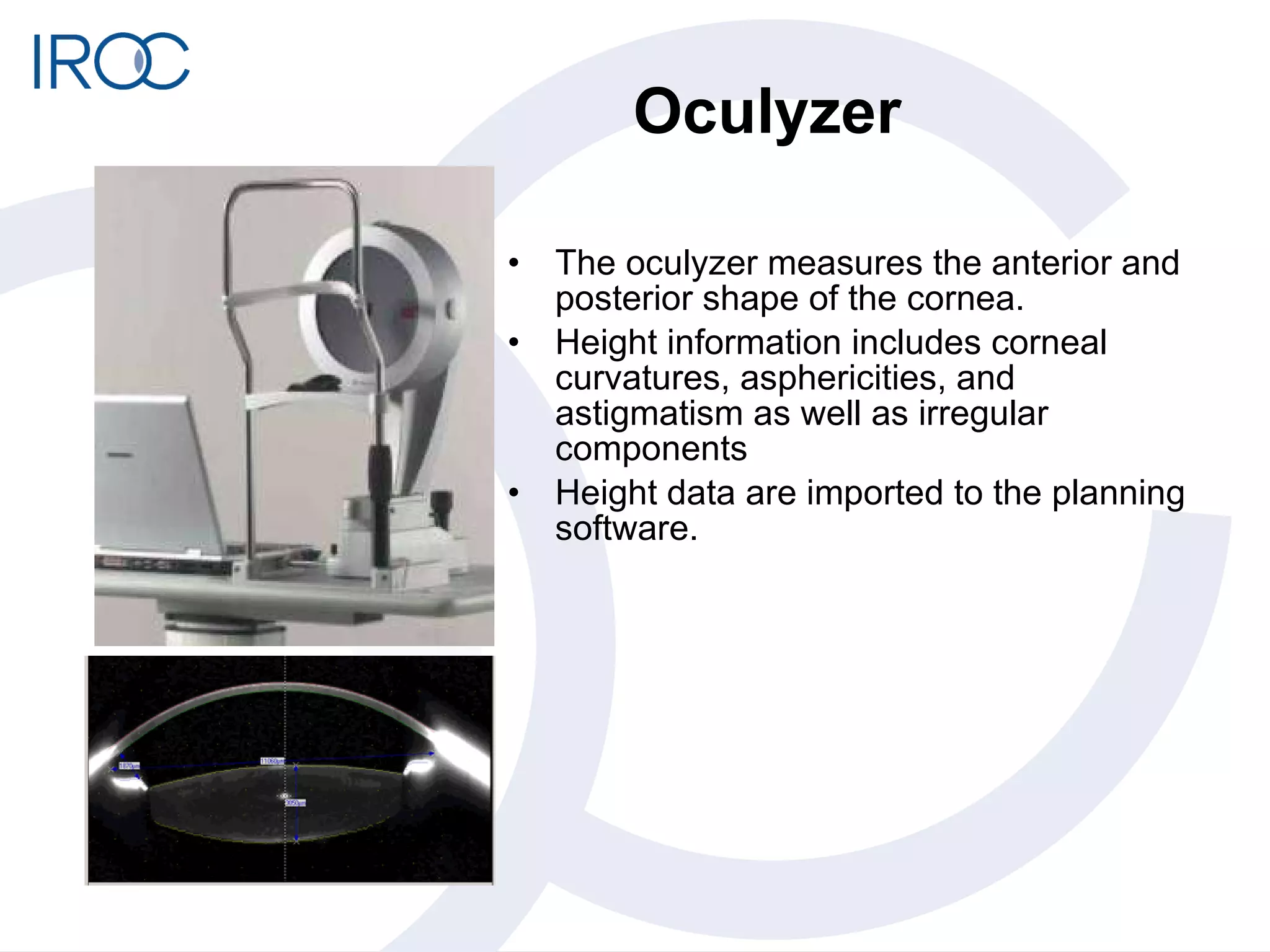 Oculyzer The oculyzer measures the anterior and posterior shape of the cornea. Height information includes corneal curvatures, asphericities, and astigmatism as well as irregular components Height data are imported to the planning software.  