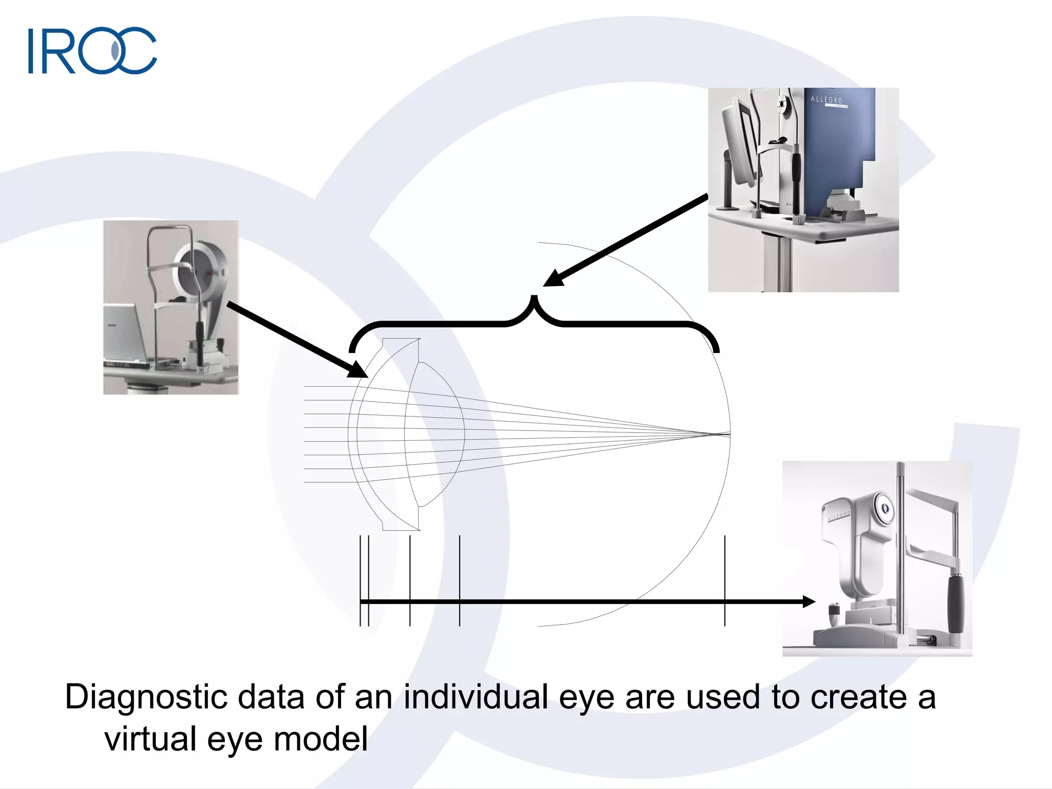 Diagnostic data of an individual eye are used to create a virtual eye model 