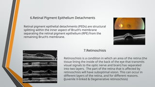 Optical coherence tomography (OCT) retinal examination.pptx