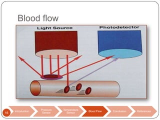 Blood flow

16

Introduction

Pressure
Sensor

Temperature
Sensor

Blood Flow

Conclusion

References

 