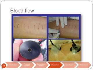 Blood flow

18

Introduction

Pressure
Sensor

Temperature
Sensor

Blood Flow

Conclusion

References

 