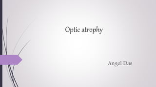 Optic atrophy
Angel Das
 