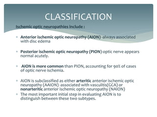 Optic atrophy | PPTX