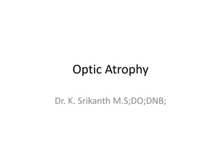 Optic Atrophy
Dr. K. Srikanth M.S;DO;DNB;
 