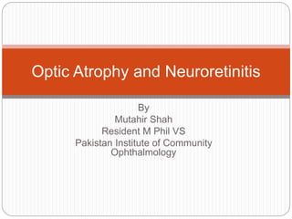 By
Mutahir Shah
Resident M Phil VS
Pakistan Institute of Community
Ophthalmology
Optic Atrophy and Neuroretinitis
 