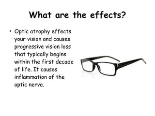 What are the effects?
●
Optic atrophy effects
your vision and causes
progressive vision loss
that typically begins
within the first decade
of life. It causes
inflammation of the
optic nerve.