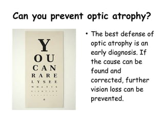 Can you prevent optic atrophy?
●
The best defense of
optic atrophy is an
early diagnosis. If
the cause can be
found and
corrected, further
vision loss can be
prevented.