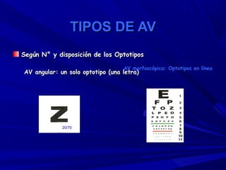 TIPOS DE AVTIPOS DE AV
Según N° y disposición de los OptotiposSegún N° y disposición de los Optotipos
AV angular: un solo optotipo (una letra)AV angular: un solo optotipo (una letra)
20/70
AV morfoscópica: Optotipos en línea
 
