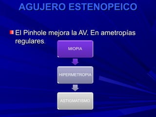 AGUJERO ESTENOPEICOAGUJERO ESTENOPEICO
El Pinhole mejora la AV. En ametropíasEl Pinhole mejora la AV. En ametropías
regularesregulares..
 